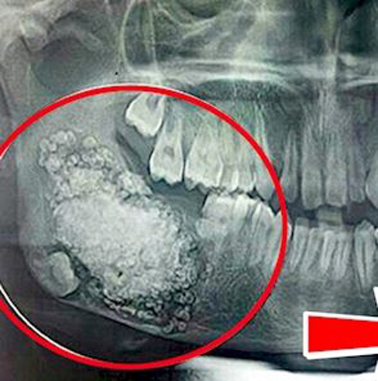 صور| تعرضت لوجع قاتل في اسنانها وعندما ذهبت للطبيب صعق مما وجد