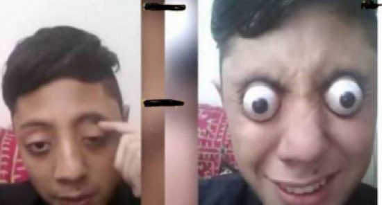 بالفيديو: شاب يسعى لدخول "غينيس".. لن تصدقوا ماذا يفعل في عينيه!