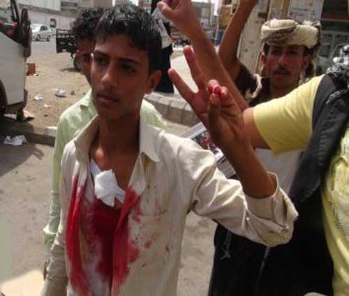 قتيلان برصاص الأمن خلال تفريق محتجين جنوب اليمن