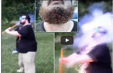 شاهد.. هذا ما يحدث عندما تشعل الألعاب النارية قرب وجهك