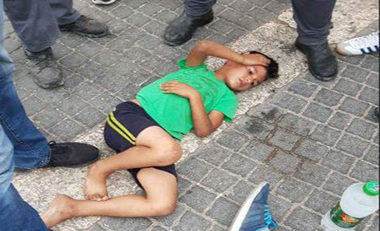 مستوطن يدهس 4 أطفال فلسطينيين بالقدس (صور) مستوطن يدهس 4 أطفال فلسطينيين بالقدس (صور)