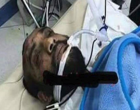 مصر.. منفذ هجوم كنيسة حلوان حي وخضع لجراحة