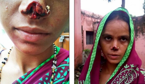 قطع أنف زوجته وهرب به.. السبب مفاجئ!