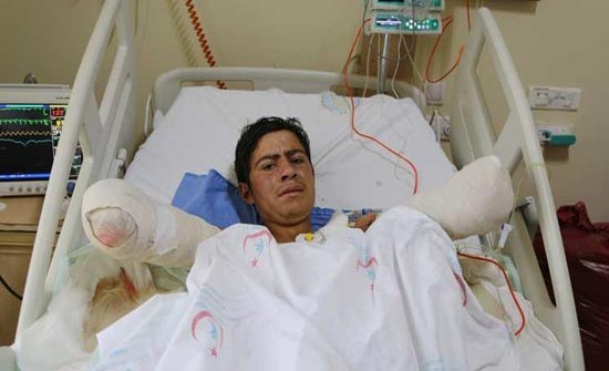 شاب يخسر ذراعيه لينقذ حمامة.. هذا ما طلبه بعد المأساة! شاب يخسر ذراعيه لينقذ حمامة.. هذا ما طلبه بعد المأساة!