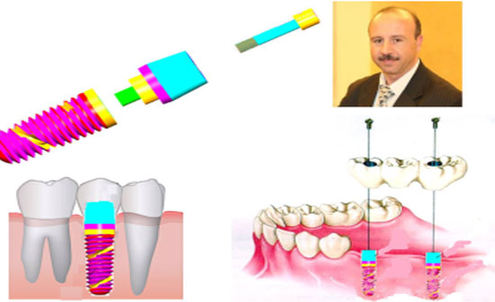 أكاديمي من "الأردنية" يسجل براءة اختراع في الغرسات السنية