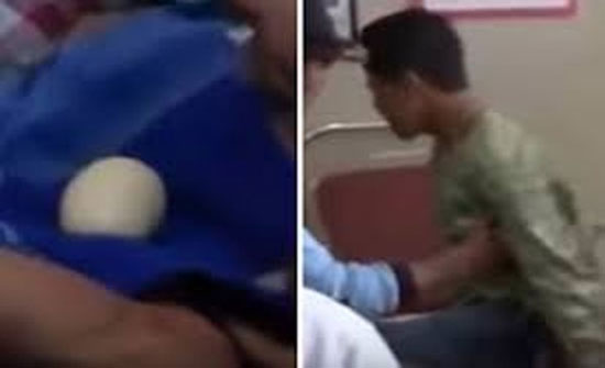 شاهد بالفيديو..صبي "يبيض" والأطباء حائرون شاهد بالفيديو..صبي "يبيض" والأطباء حائرون