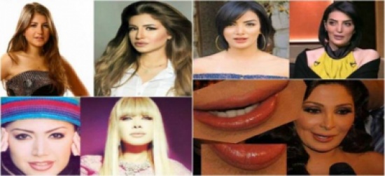 صور| 9 فنانات دمرتهن عمليات التجميل! صور| 9 فنانات دمرتهن عمليات التجميل!
