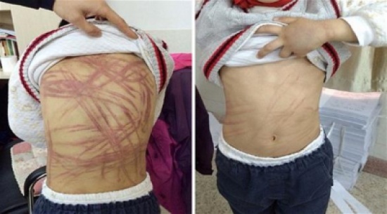 جلد طفل بالسياط لأنه لا يعرف قصة "بينوكيو"