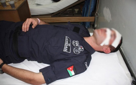 إصابة خطيرة لشرطي بالمفرق عن طريق الخطأ