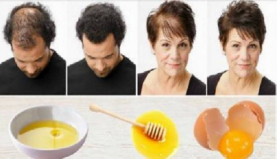 وصفة سحرية لإعادة إنبات الشعر بأسرع وقت ممكن!