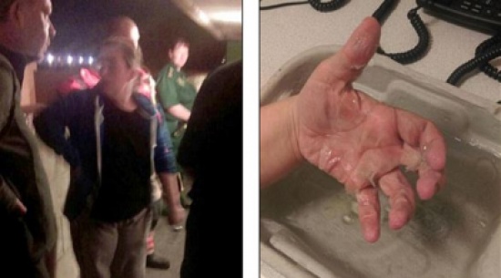 امرأة تلتصق بباب منزلها لمدة 3 ساعات