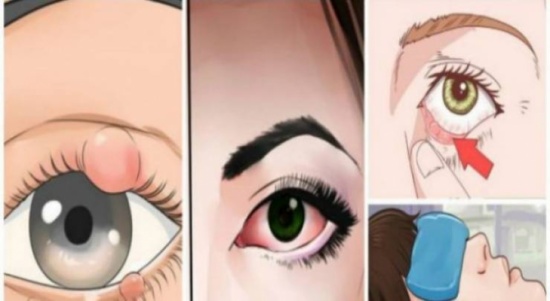 إذا ظهرت هذه العلامات على عينيك.. فعليك استشارة الطبيب فوراً!