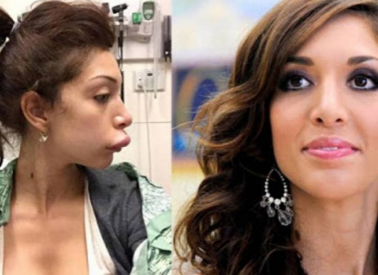 فيديو : ممثلة امريكية تتحول إلى شبح بعد عملية تجميل فيديو : ممثلة امريكية تتحول إلى شبح بعد عملية تجميل