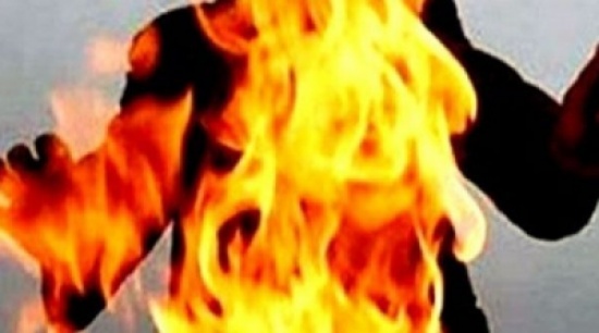 عامل يمنيّ يحرق نفسه في سحاب (التفاصيل) عامل يمنيّ يحرق نفسه في سحاب (التفاصيل)