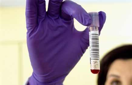 يوم مفتوح بالزرقاء حول مرض الثلاسيميا