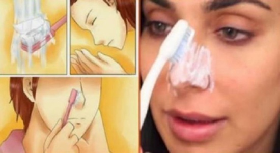 تخلصوا من الرؤوس السوداء بهذه الطريقة السهلة والمضمونة!