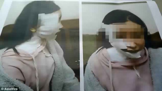 شاهد.. رجل يسلخ وجه زوجته بالـ"شوربة المغلية" شاهد.. رجل يسلخ وجه زوجته بالـ"شوربة المغلية"