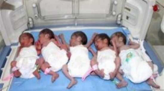 سعودية تضع 5 توائم بصحة جيدة