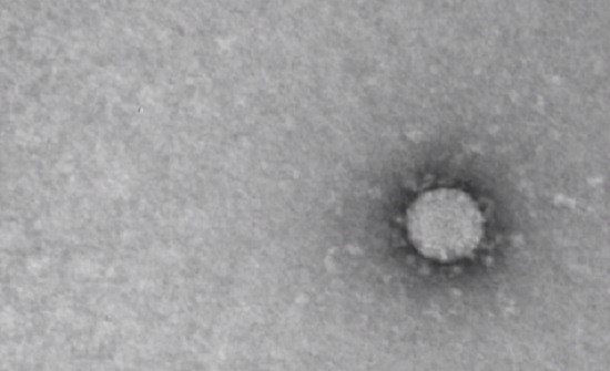 عبيدات  : بعد الاصابات المرتفعة ...  الاجراءات السابقة لن تعود