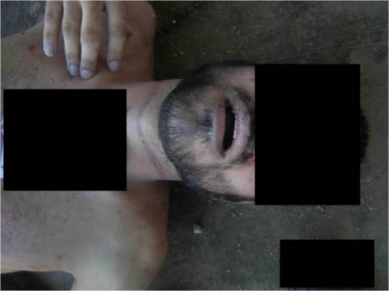 العبداللات : أردنيون في صور التعذيب بسجون الأسد