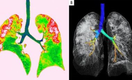 تفاصيل قبل اكتشاف إصابة كورونا في الكرك