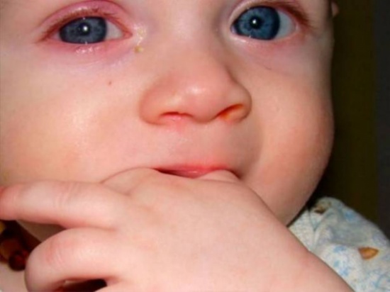 طفلةٌ إلتقط والدها صورةً لها.. فأصيبت بالعمى! طفلةٌ إلتقط والدها صورةً لها.. فأصيبت بالعمى!
