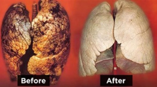 كيف تنظف رئتيك بالكامل في 72 ساعة فقط