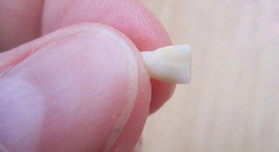 لا تتخلص من الأسنان التي يفقدها ابنك الصغير لأنها من الممكن أن تنقذ حياته فى المستقبل من أمراض خطيرة. تعرف على السبب لا تتخلص من الأسنان التي يفقدها ابنك الصغير لأنها من الممكن أن تنقذ حياته فى المستقبل من أمراض خطيرة. تعرف على السبب