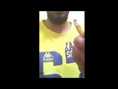 سعودي يحرق لسانه لإثبات مقدار عشقه لحبيبته (فيديو)