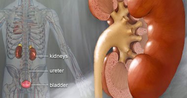 اشرب مياه وقلل المخلل والفواكه المالحة لتجنب الإصابة بالمغص الكلوي والحصوات