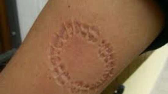 الحبس لشاب "عض" شرطيا لسبب صادم