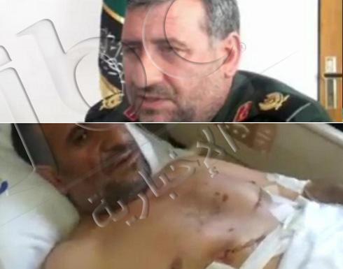 صور : إصابة قائد إيراني كبير في معارك بيجي صور : إصابة قائد إيراني كبير في معارك بيجي