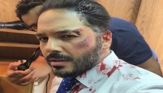 رامي عياش يتعرض للضرب ... تفاصيل رامي عياش يتعرض للضرب ... تفاصيل