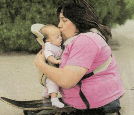 امرأة بنصف جسد تنجب مرتين رغم استحالة الامر !