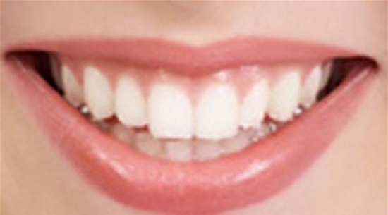7 أشياء تخبرها أسنانك عن صحتك 7 أشياء تخبرها أسنانك عن صحتك