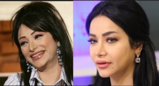 بالصور - تفصيل غير متوقّع غيّر وجوه هؤلاء النجمات.. شاهدوا كيف أصبحن! بالصور - تفصيل غير متوقّع غيّر وجوه هؤلاء النجمات.. شاهدوا كيف أصبحن!