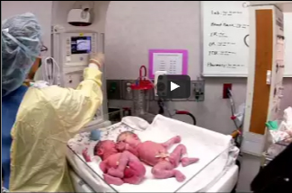 شاهد.. ردة فعل توأم يتقابلان لأول مرة