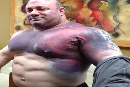 بالفيديو .. لاعبو كمال أجسام انفجرت عضلاتهم! بالفيديو .. لاعبو كمال أجسام انفجرت عضلاتهم!