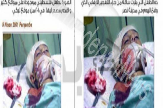 الداخلية المصرية " تفبرك " صورة لطفل فلسطيني على انه من ضحايا تفجير القاهرة الداخلية المصرية " تفبرك " صورة لطفل فلسطيني على انه من ضحايا تفجير القاهرة