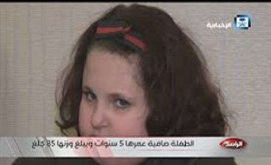 حالة غريبة لطفلة سعودية تأكل ولا تشبع (فيديو) حالة غريبة لطفلة سعودية تأكل ولا تشبع (فيديو)