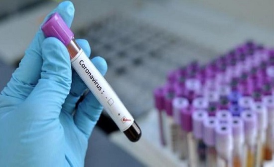 نتائج 131 عينية عشوائية سلبية بالكرك