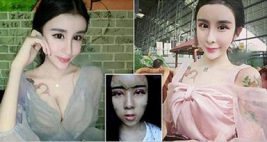 صور: مراهقة صينية تخضع لعدد من عمليات التجميل والنتيجة مذهلة
