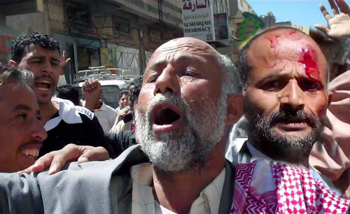 ثلاثة جرحى في مواجهات بين متظاهرين معارضين وموالين للرئيس اليمني في صنعاء