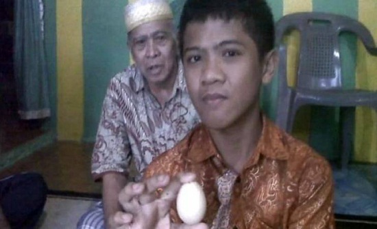 فيديو| هذا الفتى 'يبيض' كالدجاج ووضع 20 بيضة خلال عامين!