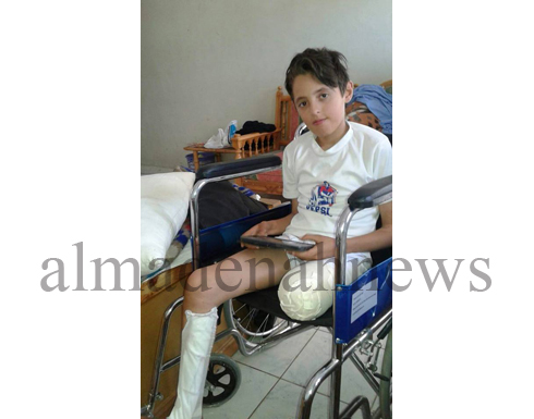 طفل أردني بقدم واحدة انقطعت به السبل في مصر