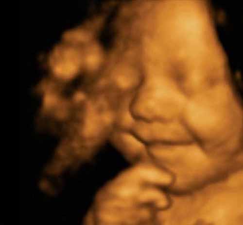 بالصور: جنين يبتسم داخل رحم أمه بالصور: جنين يبتسم داخل رحم أمه