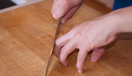 بريطاني يقطع يده بسكين ويلقيها في سلة مهملات ثم يحرقها