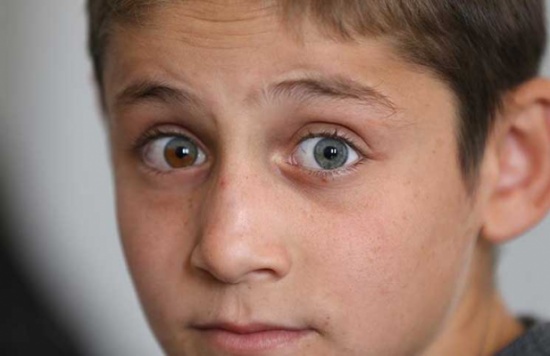“سبحان الله” .. طفل سوري عينه اليسرى “زرقاء” واليمنى “بنية”! “سبحان الله” .. طفل سوري عينه اليسرى “زرقاء” واليمنى “بنية”!