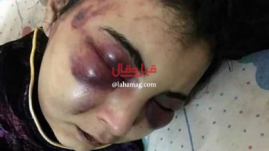 لإنها أنشأت صفحة على فيسبوك شاهدوا ماذا فعل زوجها بها!!! لإنها أنشأت صفحة على فيسبوك شاهدوا ماذا فعل زوجها بها!!!