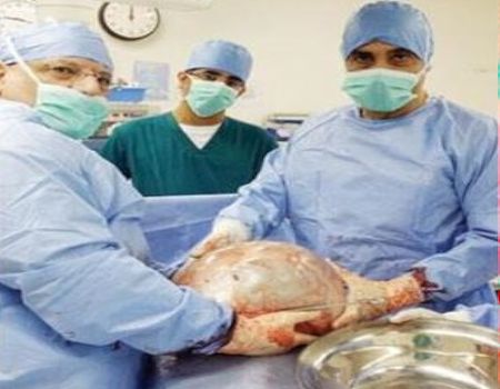 استئصال ورم بوزن 12 كيلوغراماً من رحم امرأة